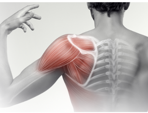 What is Really Causing my Shoulder Pain?
