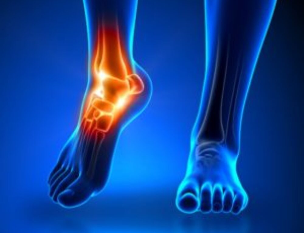 Can I check and selfcorrect hip alignment at home? John Goetze Physical Therapy